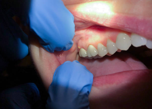 Best Emergency TMJ Treatment in Frostburg, MD