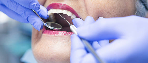 Best Emergency Dental Care for Broken or Chipped Teeth in Frostburg, MD