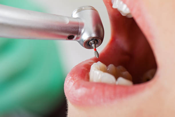 Best Emergency Denture Repair in Frostburg, MD